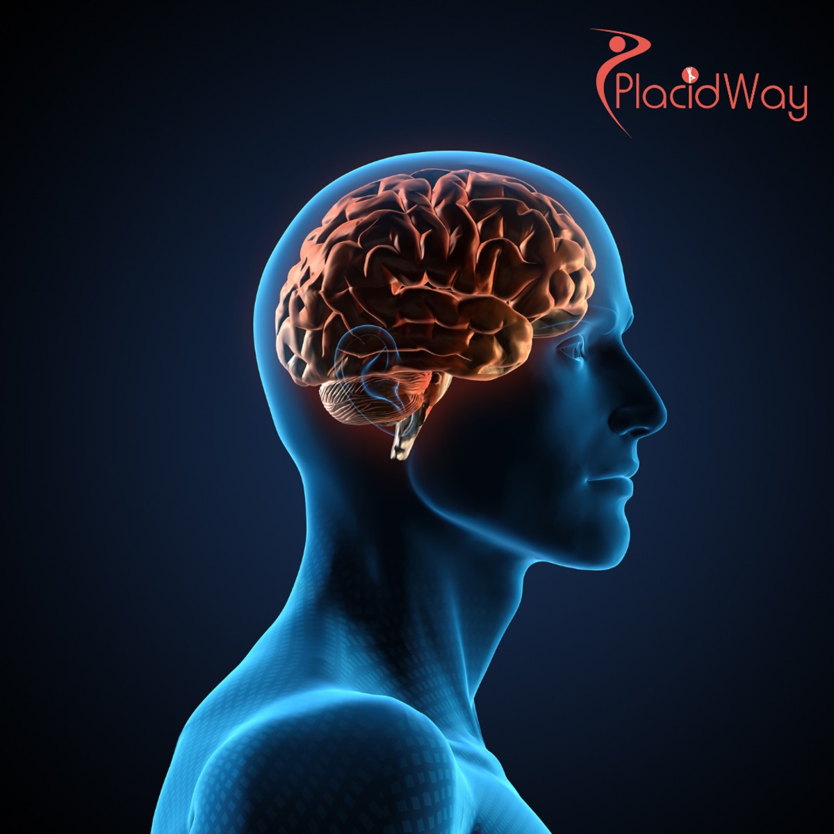 العلاج بالخلايا الجذعية لإصابات الدماغ الرضية: دليل للعلاج التجديدي المتقدم في الإمارات العربية المتحدة وخارجها