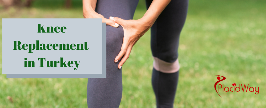 جراحة استبدال مفصل الركبة في تركيا من قبل أفضل عيادات العظام