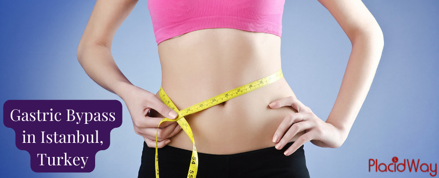 جراحة تحويل مسار المعدة بأسعار معقولة في اسطنبول - احصل على عرض أسعار مجاني الآن!