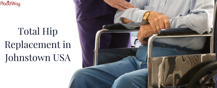 استبدال مفصل الورك بالكامل في جونستاون بالولايات المتحدة الأمريكية - للحصول على ورك جديد