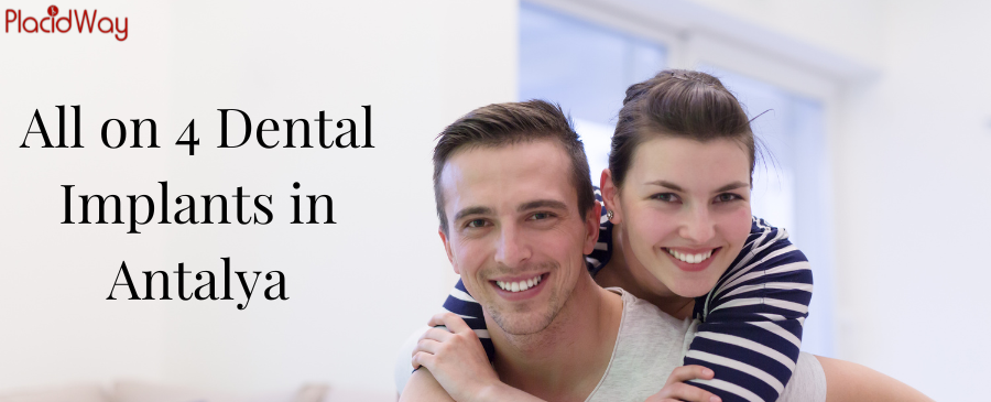 زراعة الأسنان All on 4 في أنطاليا