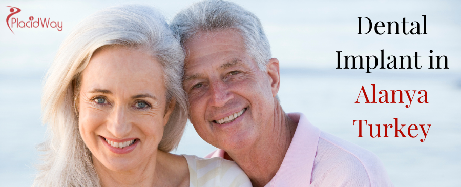 زراعة الأسنان في ألانيا تركيا