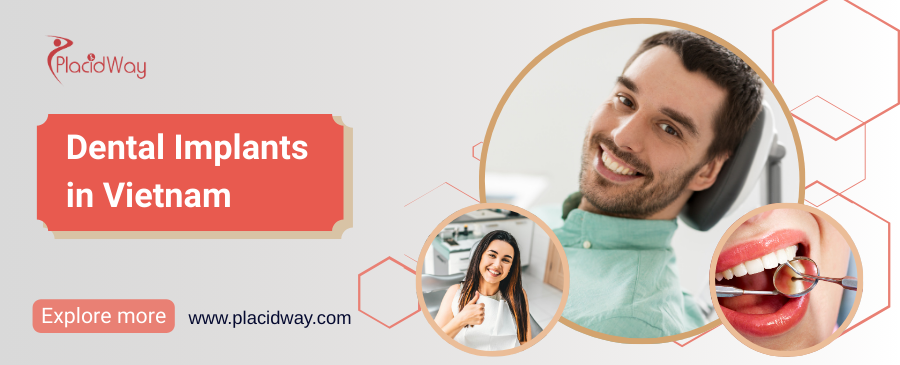 زراعة الأسنان في فيتنام