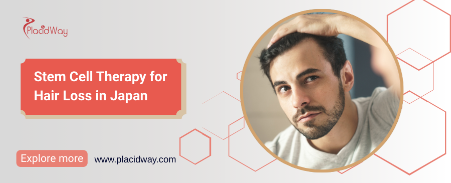 علاج تساقط الشعر بالخلايا الجذعية في اليابان