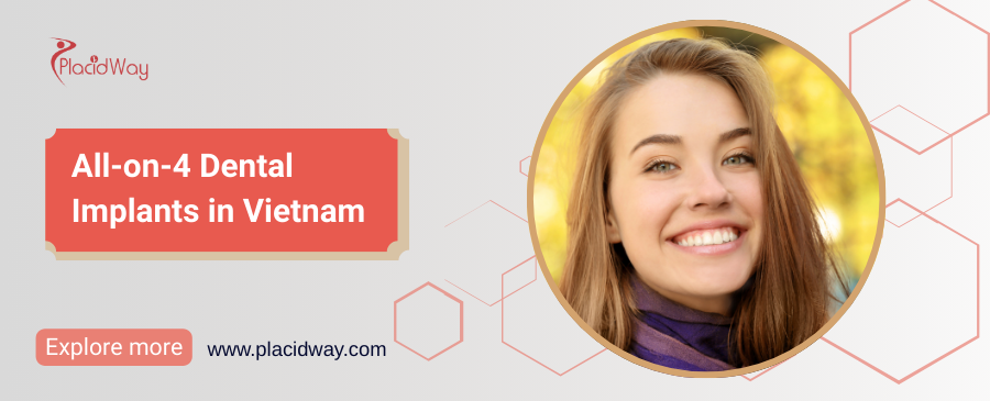 زراعة الأسنان All-on-4 في فيتنام