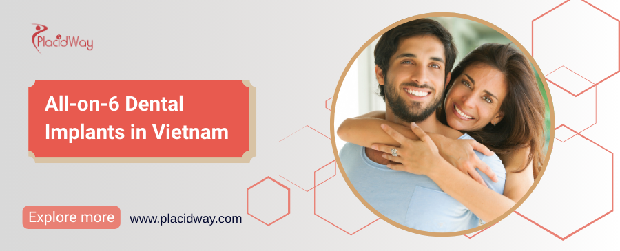 زراعة الأسنان All-on-6 في فيتنام