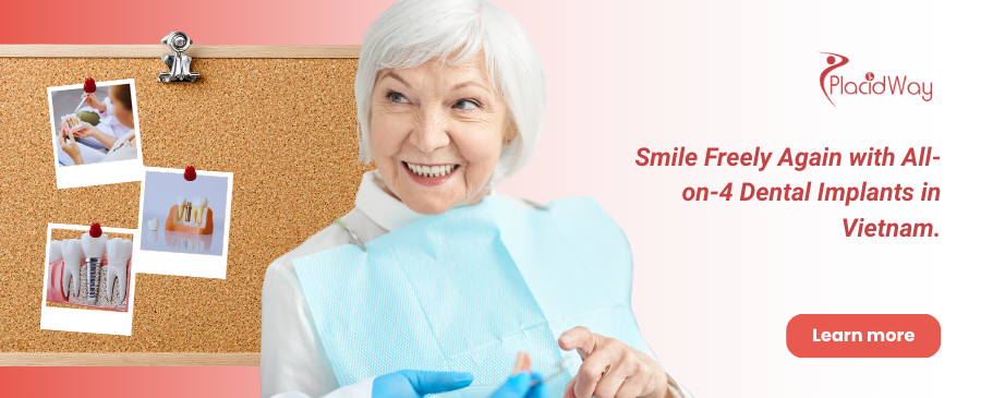 زراعة الأسنان All-on-4 في فيتنام