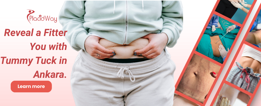 شد البطن في أنقرة، تركيا