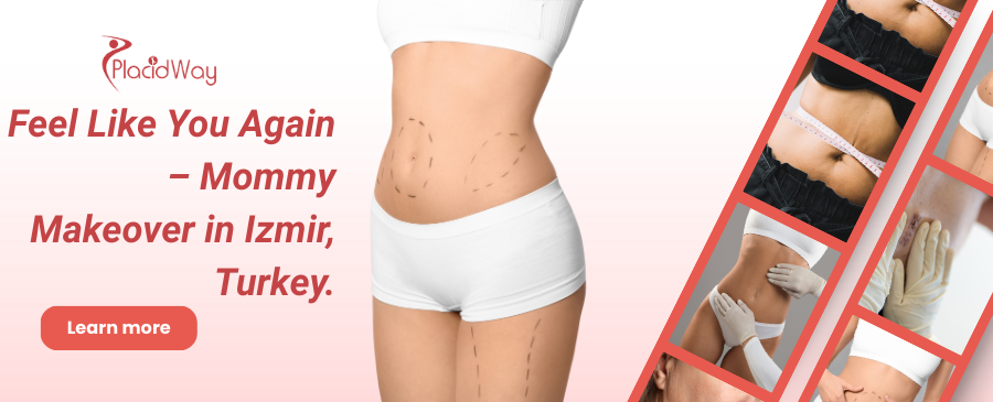 عملية تجميل الأم في إزمير، تركيا