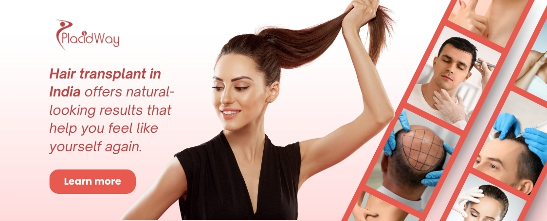 زراعة الشعر في الهند