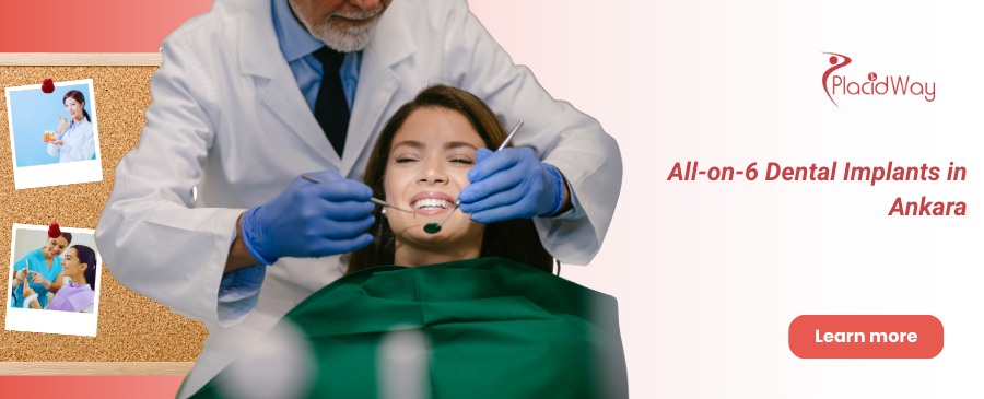 زراعة الأسنان بتقنية "أول-أون-6" في أنقرة، تركيا