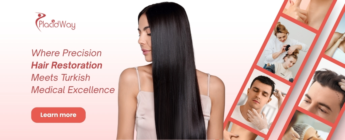 زراعة الشعر بتقنية FUE في تركيا