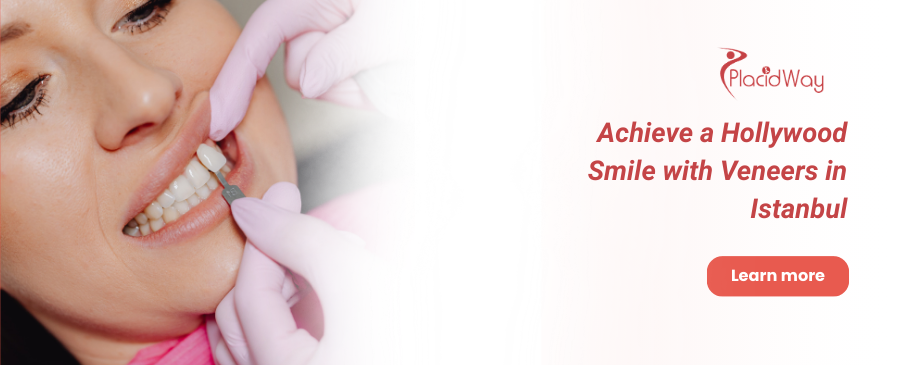 قشور الأسنان في اسطنبول