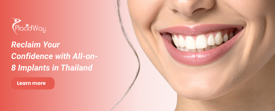 زراعة الأسنان All on 8 في تايلاند - احصل على زراعة الأسنان في الخارج 