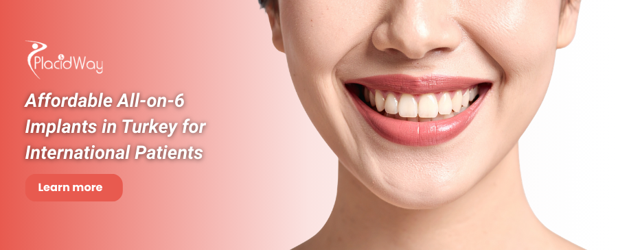 زراعة الأسنان All on 6 في تركيا