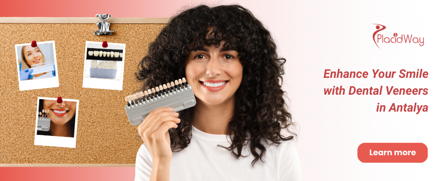 قشور الأسنان في أنطاليا